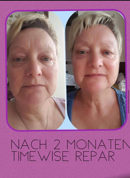 TimeWise Repair® Volu-Firm® Night Treatment  ab 45 Jahre