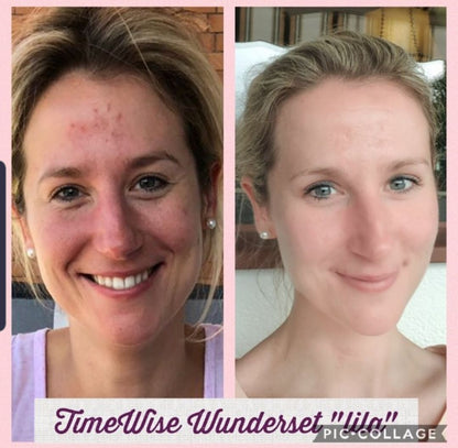 TimeWise® 4-in-1 Cleanser  ab 23 Jahre