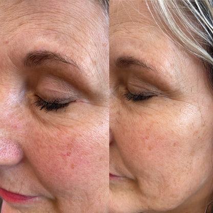 Mary Kay® Hydrogel Eye Patches